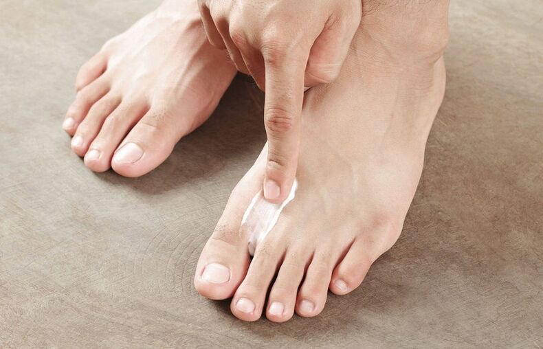 mast za liječenje gljivica noktiju na nogama