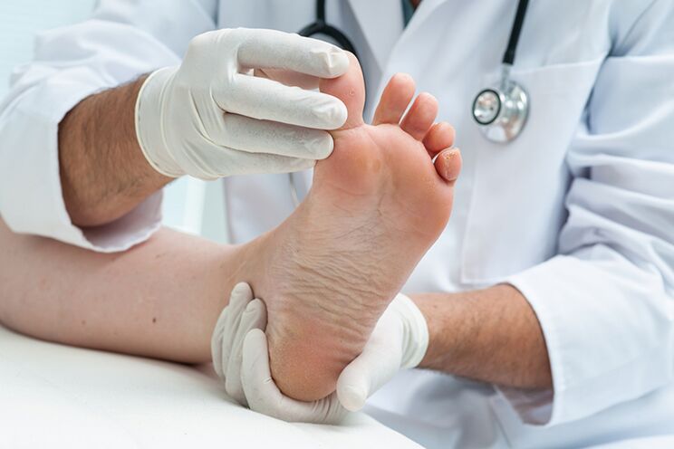 Dermatolog ispituje pacijentove noge